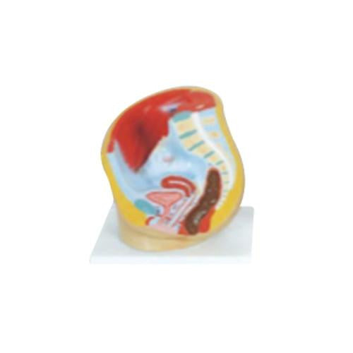 Pelvis femenina. CVQ7034