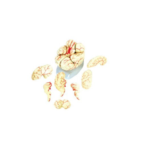Cerebro Gigante con Arterias. CVQ7008
