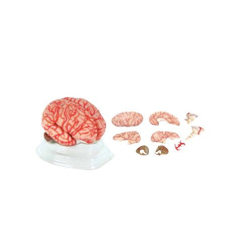 Cerebro Rosa con Arterias. CVQ7007