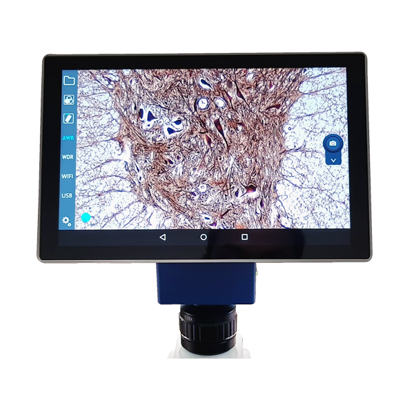 Tablet para Microscopio. VE-SCOPEPAD 300